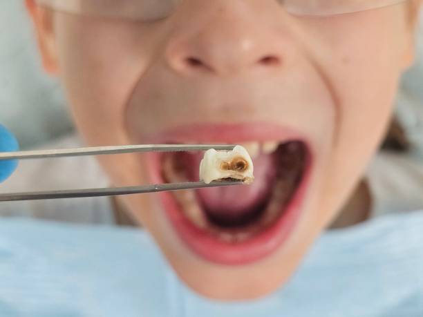 Best Holiday Emergency Dentist in Etowah, TN